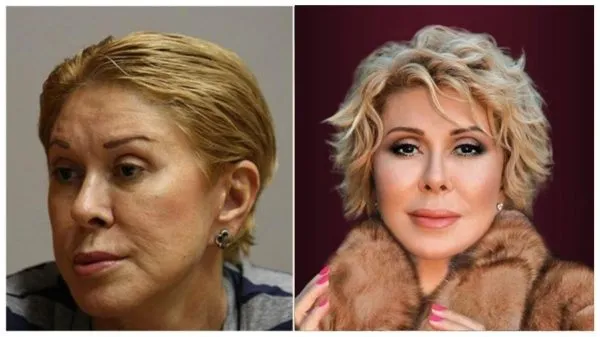 Итоги пластики и фигура 65-летней Любови Успенской – фото до и после
