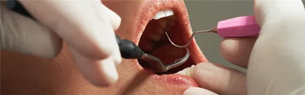 Почему не стоит бояться стоматолога 3