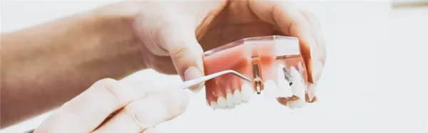 Почему не стоит бояться стоматолога 2